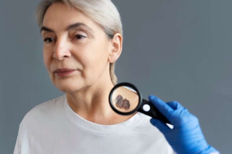 Elderly woman undergoing a skin exam with a magnifying glass to inspect a mole on her neck, highlighting skin checkups